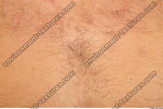 human skin hairy 0001